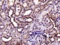 VDAC1 Recombinant Rabbit mAb, Mitochondrial Loading Control
